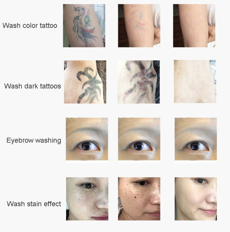 Laser Tattoo Removal Machine Non-invasive Eyebrow Washing Beauty Equipment